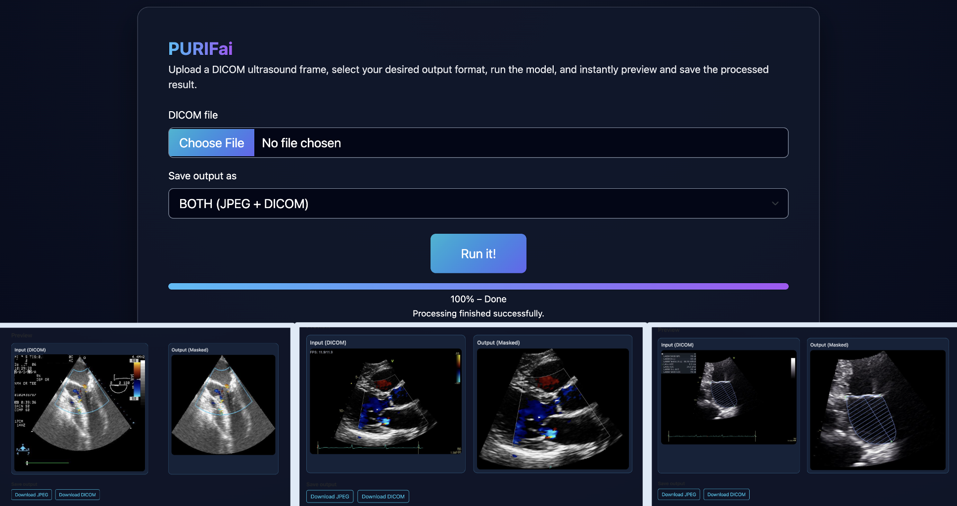 PURIFai: Ultrasound Clean & Trim
