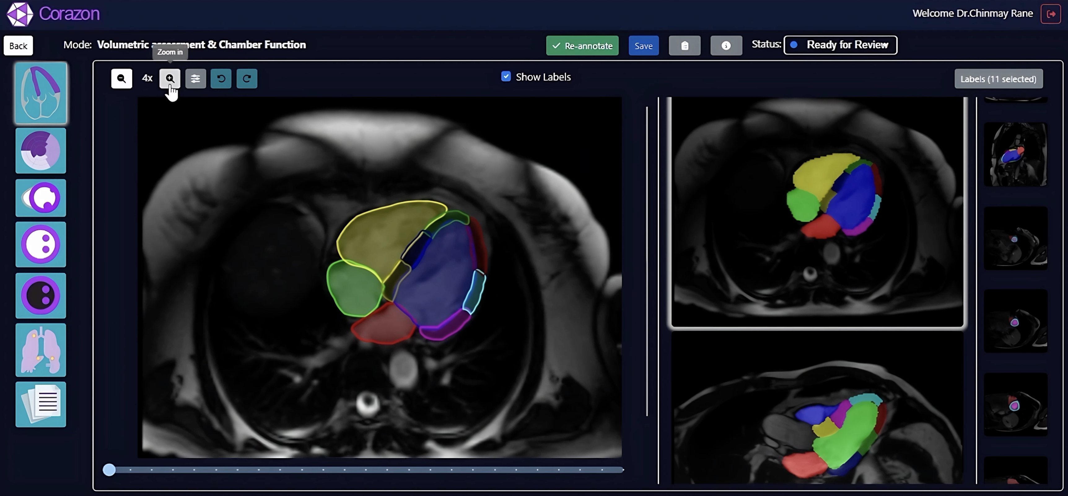 Cardiovascular Diagnostics UI